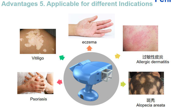XecI 308NM Excimer Light For Treating Skin Vitiligo Psoriasis 240V