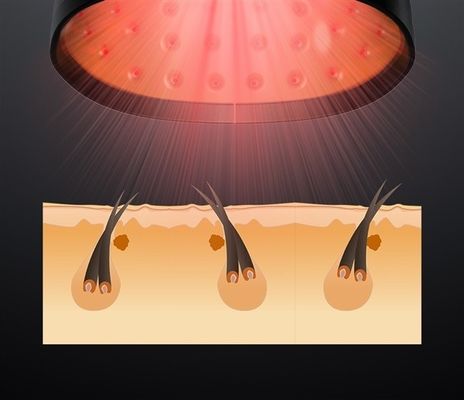 ABS 81 Diodes Laser Hair Loss Treatment HairPro Laser Therapy Cap