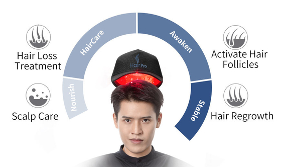 Laser Light Therapy Hair Growth Cap 81 Laser Diodes Peninsula Device
